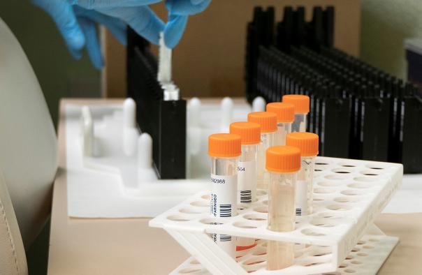 Castilla-La Mancha confirma el primer caso de infectado por COVID con la variante ómicron