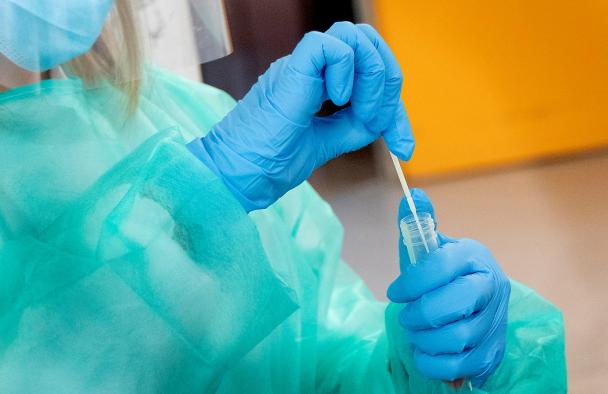 Castilla-La Mancha registra 2 nuevos casos de viruela del mono entre el 26 de agosto y el 1 de septiembre
